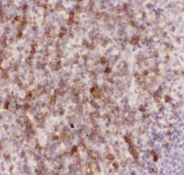 Anti-CD43/SPN Antibody Picoband® Boster Bio