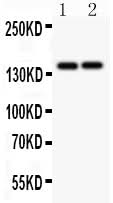 Anti-Collagen III/COL3A1 Antibody Picoband® Boster Bio