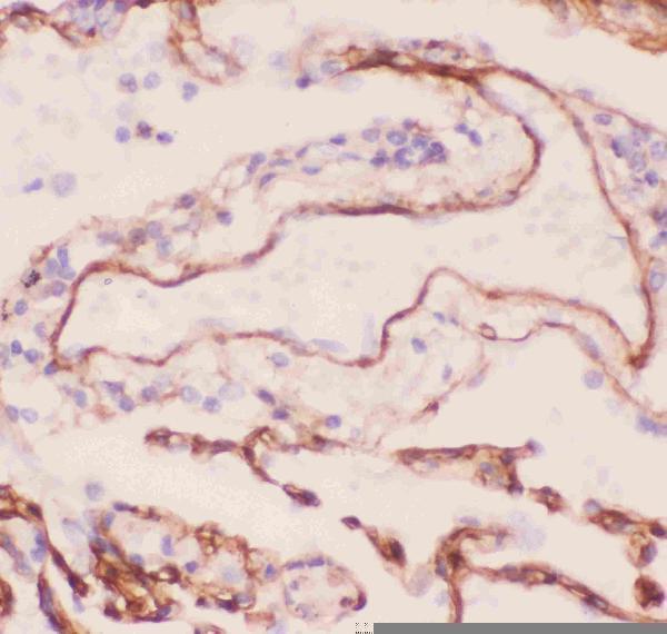 Anti-Collagen IV/COL4A1 Antibody Picoband® Boster Bio