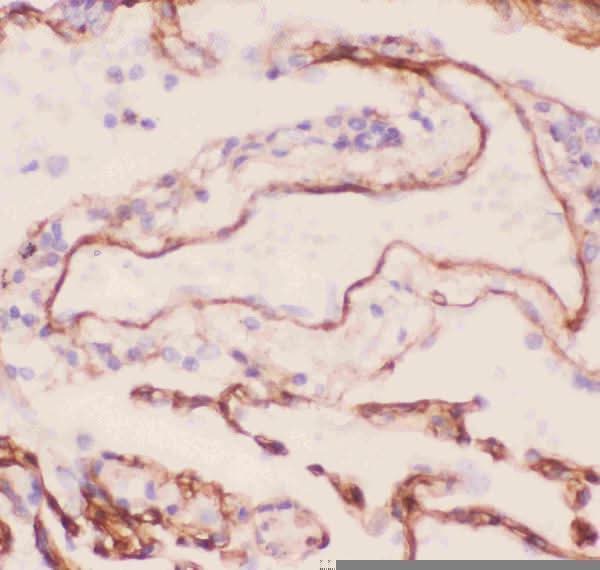 Anti-Collagen IV/COL4A1 Antibody Picoband® Boster Bio