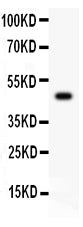 Anti-Csk Antibody Picoband® Boster Bio