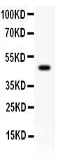 Anti-Csk Antibody Picoband® Boster Bio