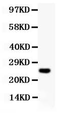 Anti-Cyclin D3/CCND3 Antibody Picoband® Boster Bio