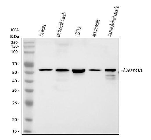 Anti-Desmin Antibody Picoband® Boster Bio