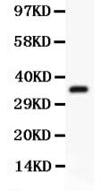 Anti-FSH beta/FSHB Antibody Picoband® Boster Bio