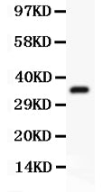 Anti-FSH beta/FSHB Antibody Picoband® Boster Bio