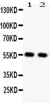 Anti-Glucose Transporter GLUT4/SLC2A4 Antibody Picoband® Boster Bio