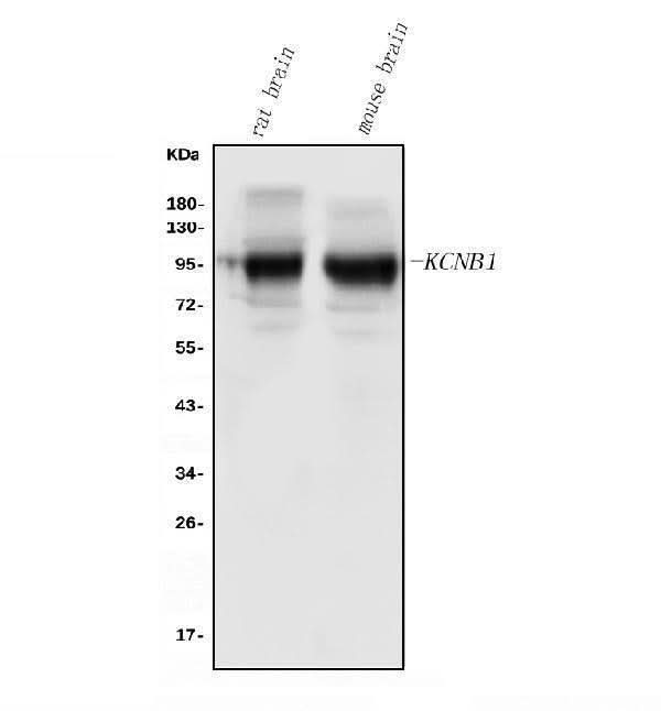 Anti-Kv2.1/KCNB1 Antibody Picoband® Boster Bio
