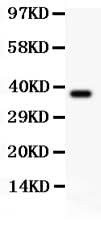 Anti-CIAS1/NALP3/NLRP3 Antibody Picoband® Boster Bio