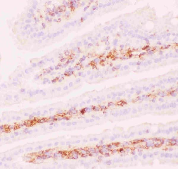 Anti-P Glycoprotein/ABCB1 Antibody Boster Bio