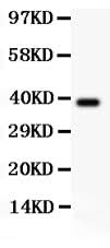 Anti-RIP/RIPK1 Antibody Picoband® Boster Bio