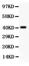 Anti-SCP3/SYCP3 Antibody Picoband® Boster Bio