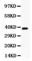 Anti-Hamartin/TSC1 Antibody Picoband® Boster Bio