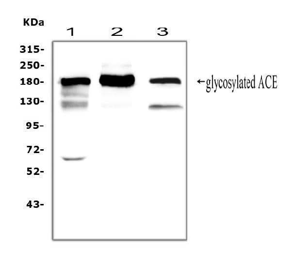 Anti-Angiotensin Converting Enzyme 1/ACE Antibody Picoband® Boster Bio
