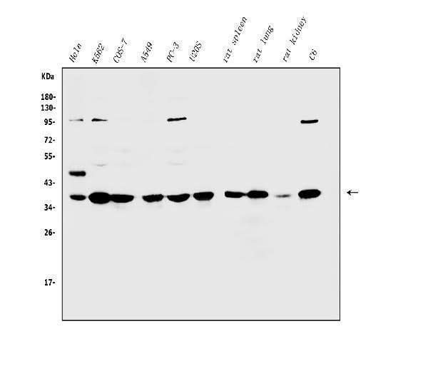 Anti-Annexin A1/ANXA1 Antibody Picoband® Boster Bio