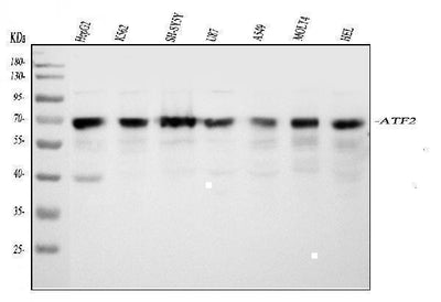 Anti-ATF2 Antibody Picoband® Boster Bio