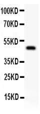 Anti-alpha 1 Catenin/CTNNA1 Antibody Picoband® Boster Bio