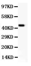 Anti-CD11b/ITGAM Antibody Picoband® Boster Bio