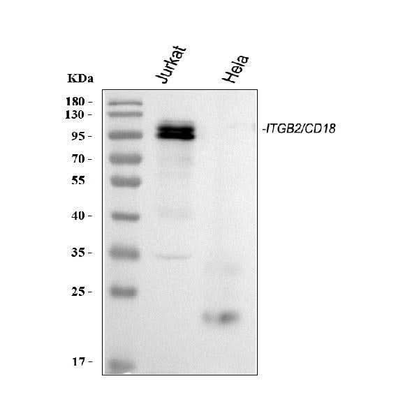 Anti-CD18/ITGB2 Antibody Picoband® Boster Bio