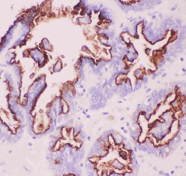 Anti-MUC1 Antibody Boster Bio