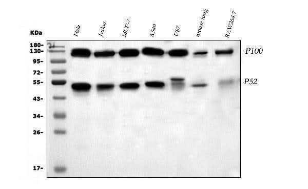 Anti-NFkB/NFKB2 p100/p52 Antibody Picoband® Boster Bio