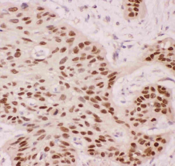 Anti-p63/TP63 Antibody Picoband® Boster Bio