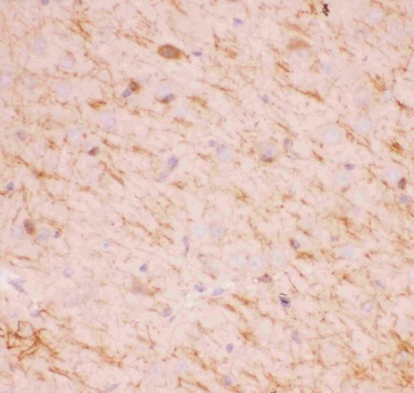 Anti-SIRT2 Antibody Picoband® Boster Bio