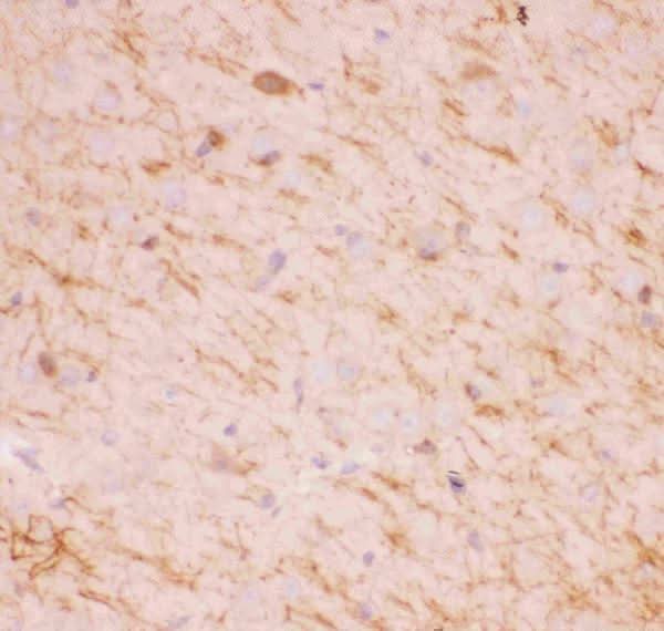 Anti-SIRT2 Antibody Picoband® Boster Bio