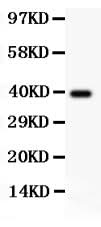 Anti-TdT/DNTT Antibody Picoband® Boster Bio