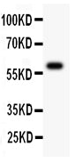 Anti-Serine-protein kinase ATM ATM Antibody Picoband® Boster Bio
