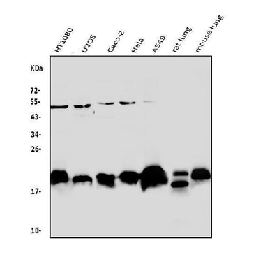 Anti-Caveolin-2/CAV2 Antibody Picoband® Boster Bio