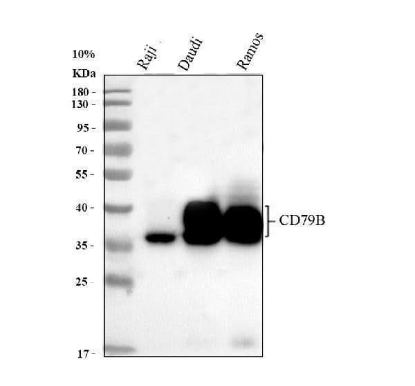 Anti-CD79b Antibody Picoband® Boster Bio