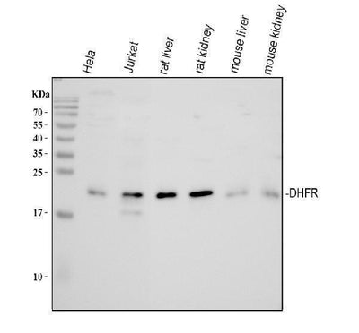 Anti-Dihydrofolate reductase (DHFR) Antibody Picoband® Boster Bio