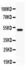 Anti-KAT3B/p300/EP300 Antibody Picoband® Boster Bio
