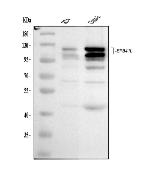 Anti-EPB41L1 Antibody Picoband® Boster Bio