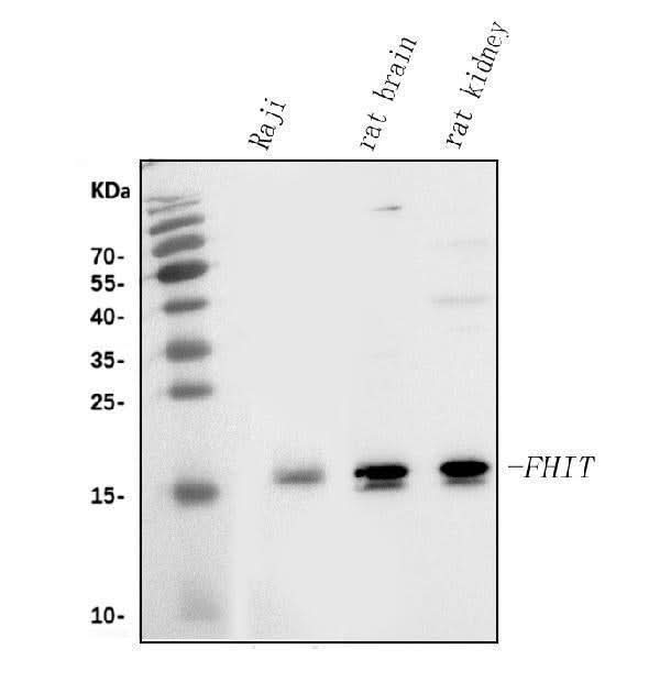 Anti-FHIT Antibody Picoband® Boster Bio