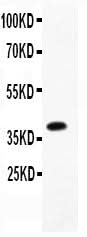 Anti-Furin Antibody Picoband® Boster Bio
