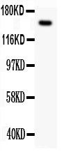 Anti-Met (c-Met) Antibody Picoband® Boster Bio