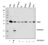 Anti-Caspase-3/CASP3 Antibody Picoband® Boster Bio
