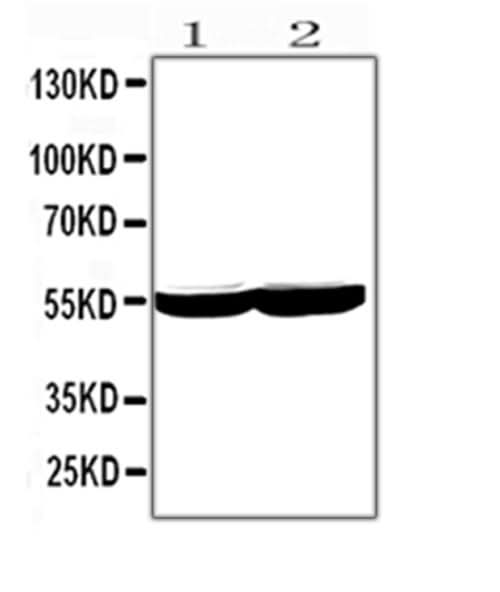 Anti-Cytochrome P450 2E1/CYP2E1 Antibody Picoband® Boster Bio
