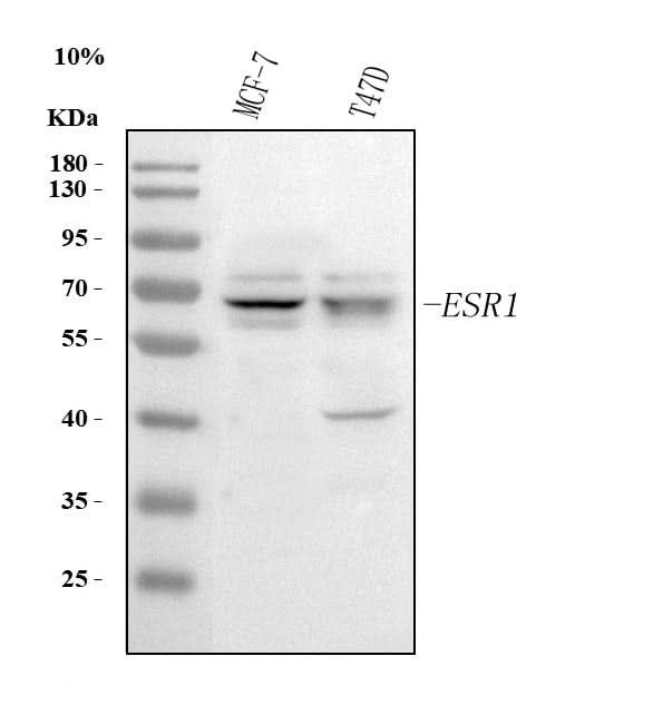 Anti-Estrogen Receptor/ESR1 Antibody Picoband® Boster Bio