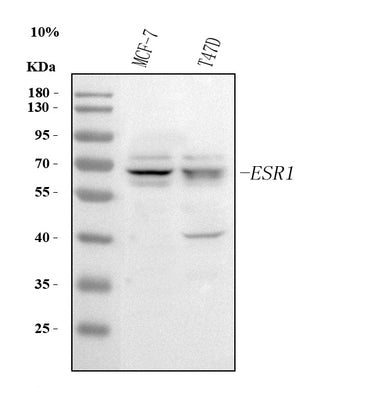 Anti-Estrogen Receptor/ESR1 Antibody Picoband® Boster Bio