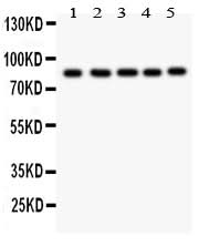 Anti-FOXM1 Antibody Picoband® Boster Bio