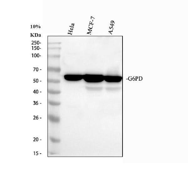 Anti-Glucose 6 Phosphate Dehydrogenase/G6PD Antibody Picoband® Boster Bio