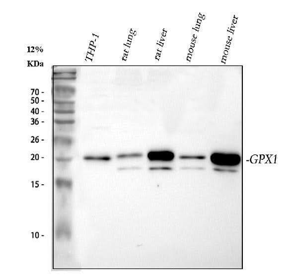 Anti-Glutathione Peroxidase 1/GPX1 Antibody Picoband® Boster Bio