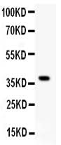 Anti-Glutamate Receptor 1/GRIA1 Antibody Picoband® Boster Bio