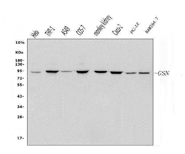 Anti-Gelsolin/GSN Antibody Picoband® Boster Bio