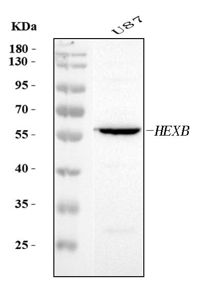 Anti-HEXB Antibody Picoband® Boster Bio