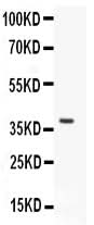 Anti-HOXA9 Antibody Picoband® Boster Bio