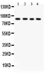 Anti-IKK beta/IKBKB Antibody Picoband® Boster Bio